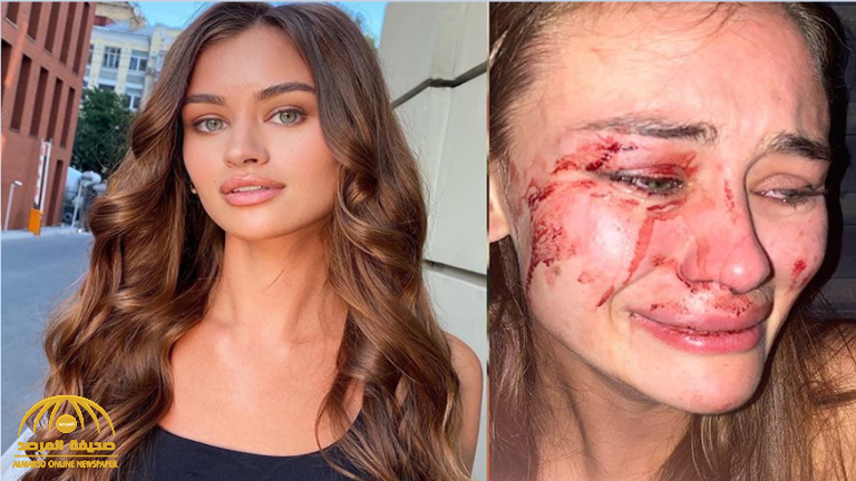 "الدماء تسيل من وجهها".. شاهد: اعتداء "عنيف" على عارضة أزياء شهيرة على شاطئ في تركيا