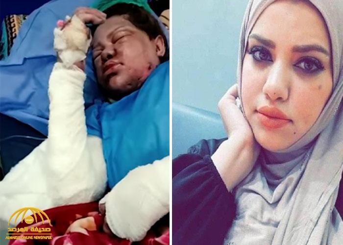 عراقيون يصدمون بوفاة الشابة "حنين الزبيدي" التي حرقها زوجها وهي حامل