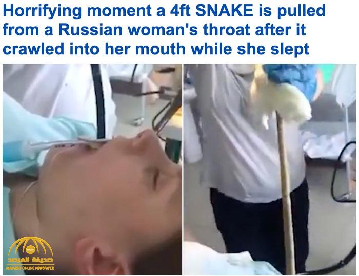 شاهد: استخراج ثعبان من داخل فم امرأة