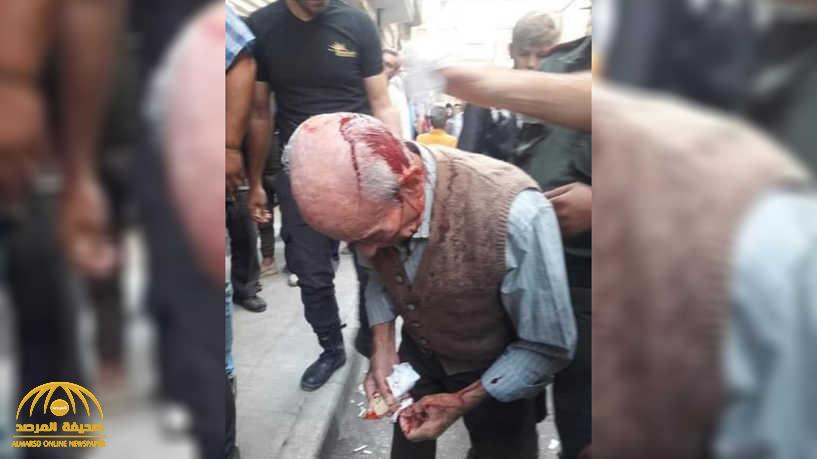شاهد: صورة صادمة لـ"مسن" تعرض للضرب المبرح في طوابير الخبز في سوريا