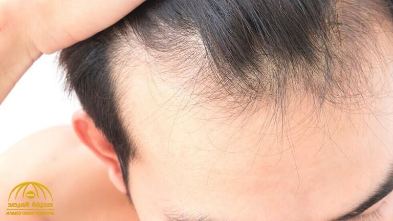 ‏مستخلص طبيعي يزيد من نمو الشعر في أيام بتحفيز بصيلات الشعر