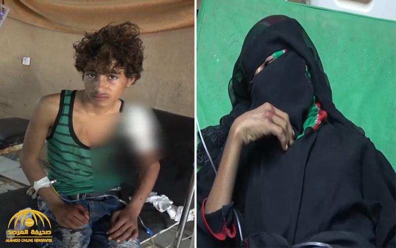 شاهد .. المليشيات الحوثية ترتكب جرائم مروعة بحق المدنيين في الحديدة