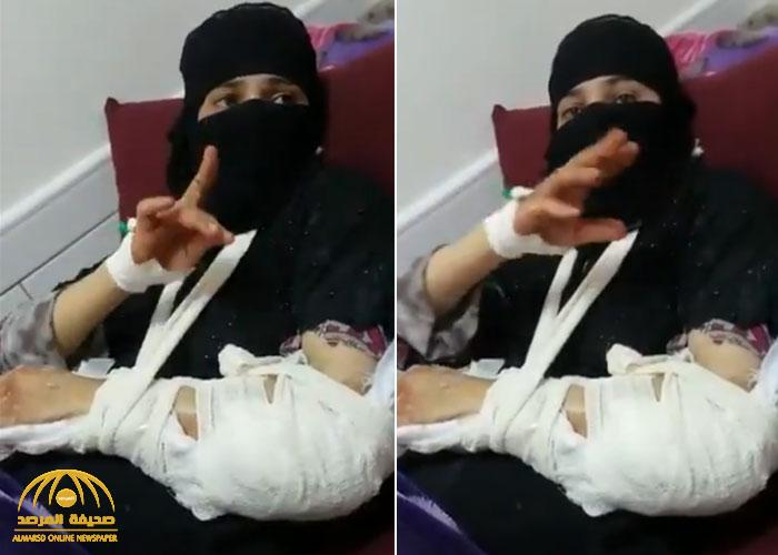شاهد:  عناصر حوثية  تعتدي على امرأة يمنية  وتكسر ذراعها