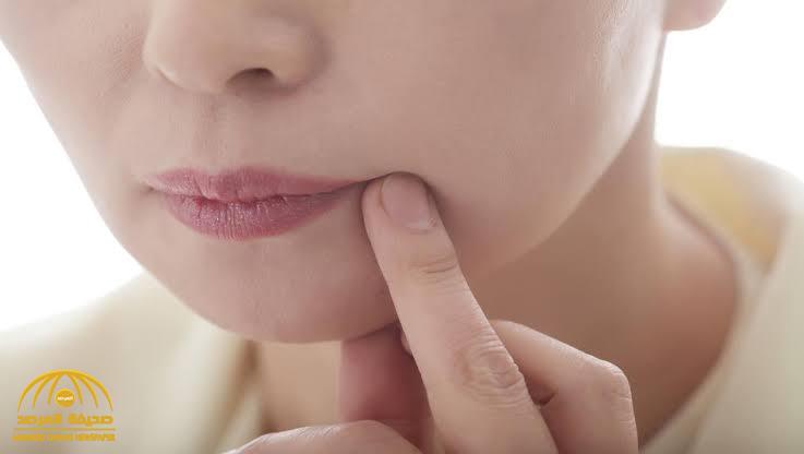 علامة في الفم تشير إلى الإصابة بمرض خطير!