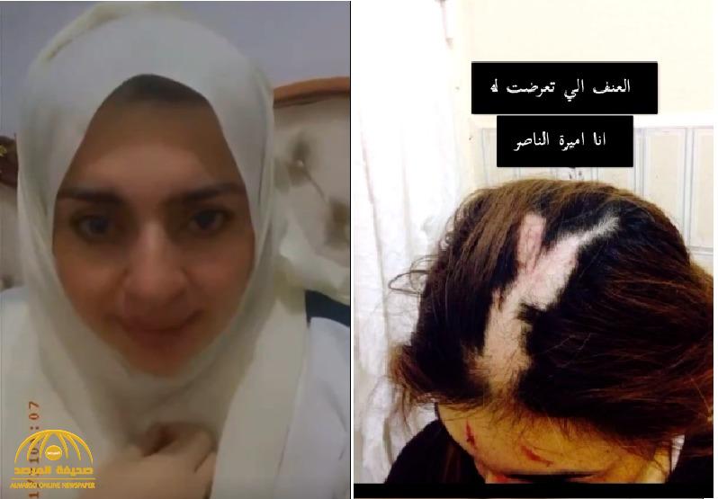 شاهد: مشهورة سناب "أميرة الناصر" تنهار باكية وتنشر صور تعرضها للضرب والعنف الجسدي