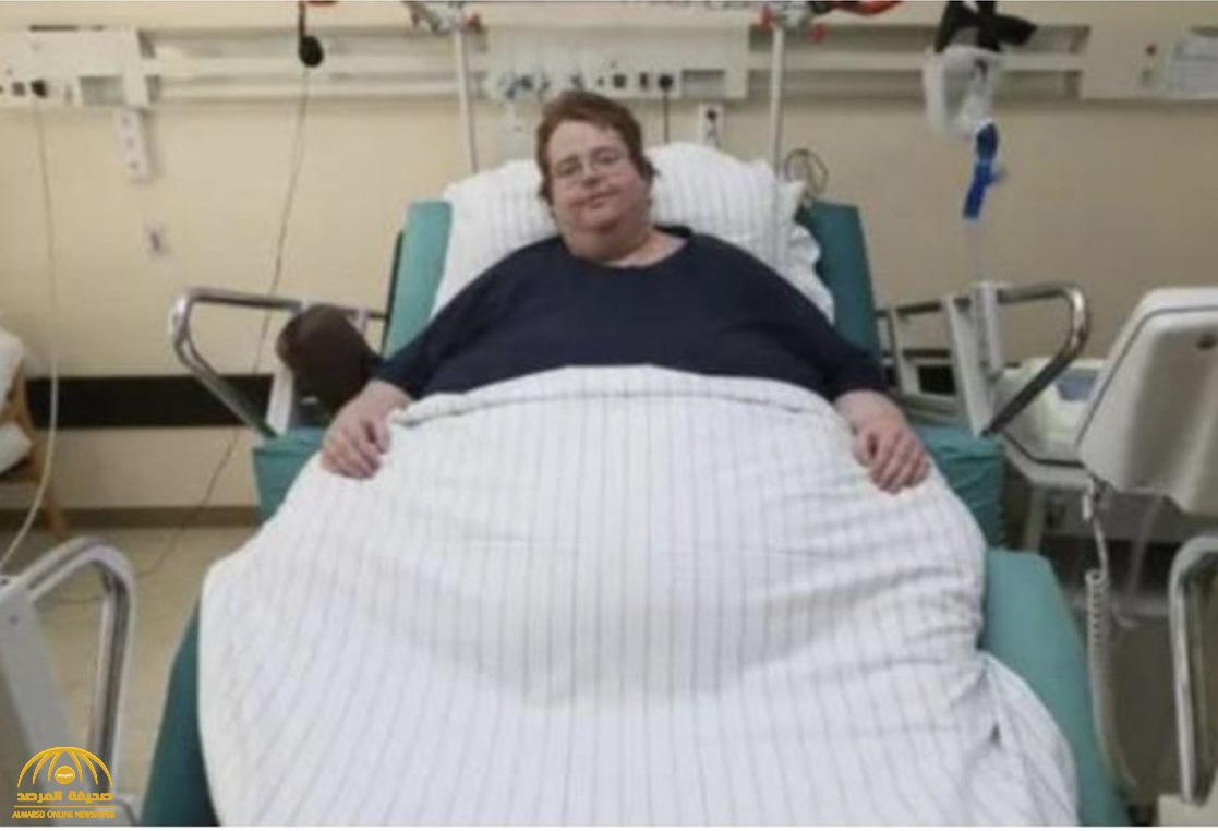 خطأ طبي غريب.. رجل سمين دخل المستشفى لإجراء عملية قلب مفتوح فأجروا له ولادة قيصرية!