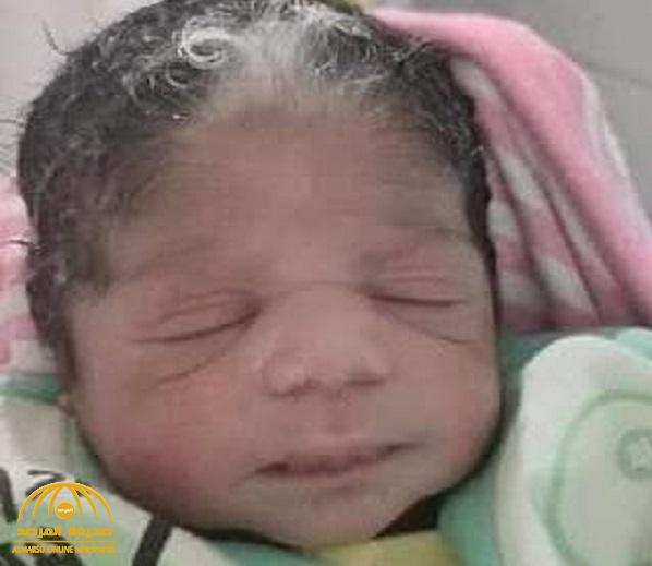 شاهد: ولادة طفلة بخصلة "شعر أبيض" تثير الجدل في مصر.. وطبيب يكشف السبب