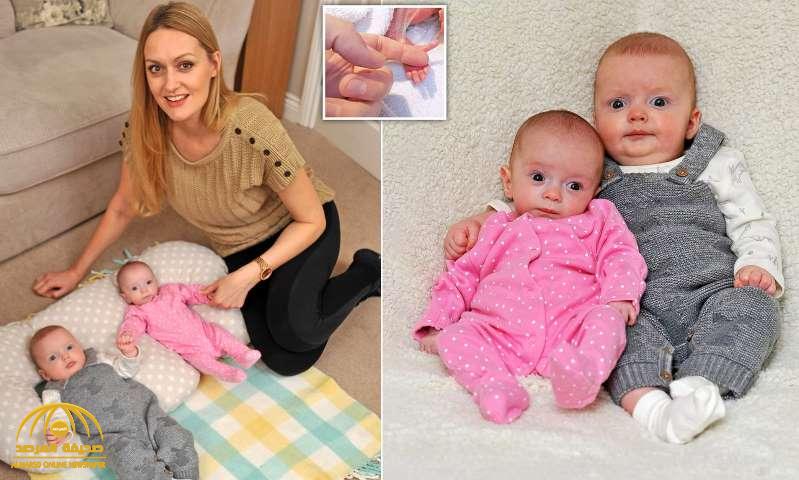 معجزة طبية .. امرأة تضع طفلين توأم أحدهما يسبق الآخر بـ 3 أسابيع - صور