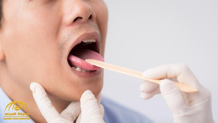 "علامتان" في الفم تدلان على ارتفاع مستويات السكر في الدم