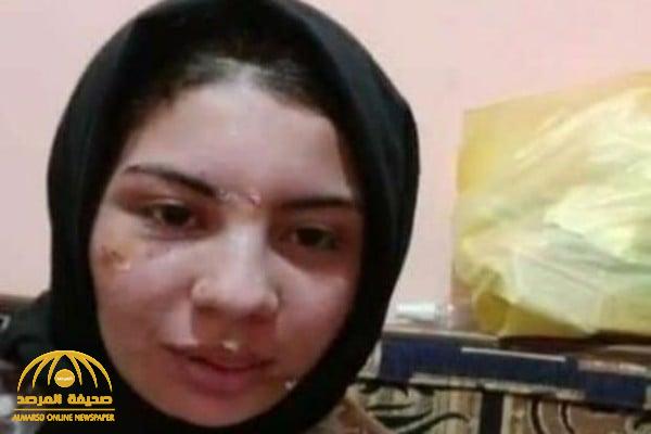 "من داخل غرفة التحقيق".. ملابسات جديدة في واقعة "إسراء" ضحية العنف بالإسكندرية بعد تقطيع وجهها وجسدها