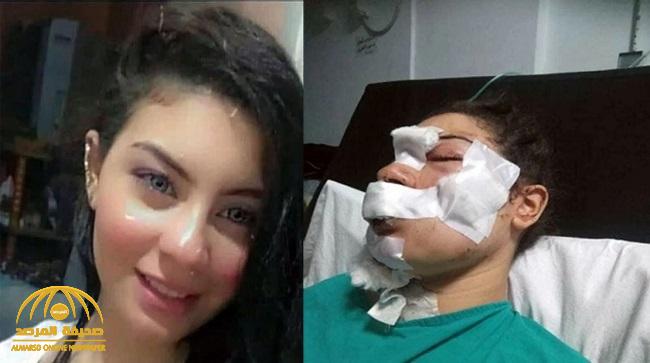 زوج المصرية "إسراء عماد" يفجر مفاجأة في قضية تشويه وجهها بـ"سكين".. وعلاقتها بصديقه