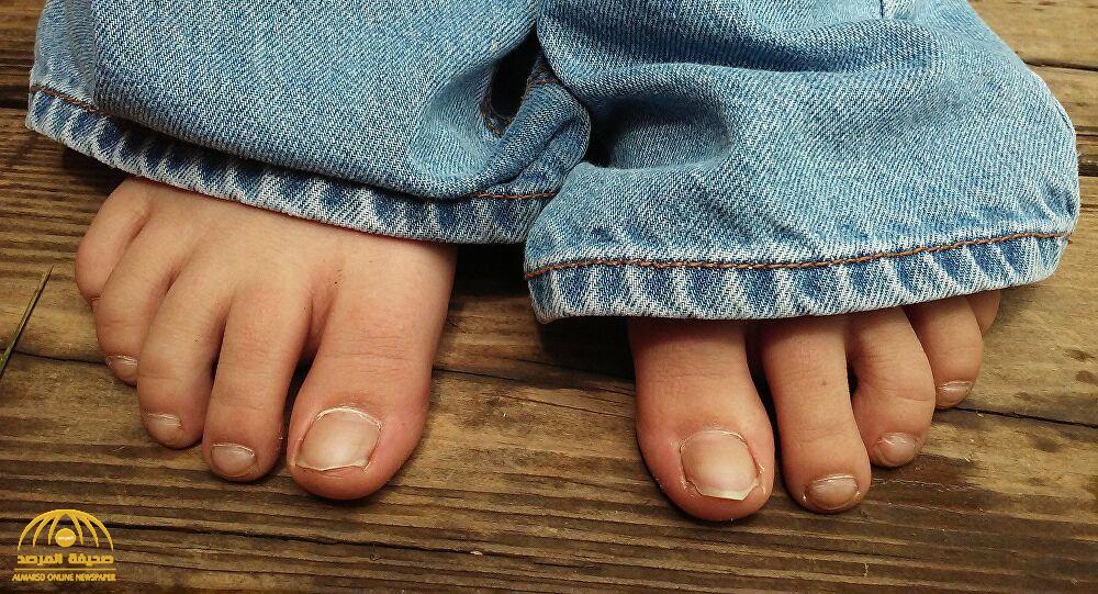 تظهر على أصابع القدمين.. علامة غير "معتادة" تدل على ارتفاع الكوليسترول الخبيث