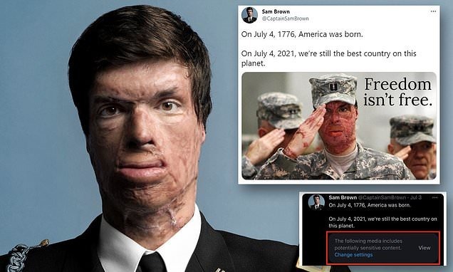 شاهد.. ضابط أمريكي أصيب بانفجار في وجهه يهاجم تويتر بعد عبارة دونها على صورته!