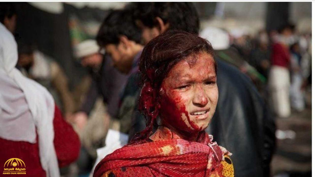 بعدما تداولت عالميا..  حقيقة صورة الطفلة المصابة  "في هجوم كابل"
