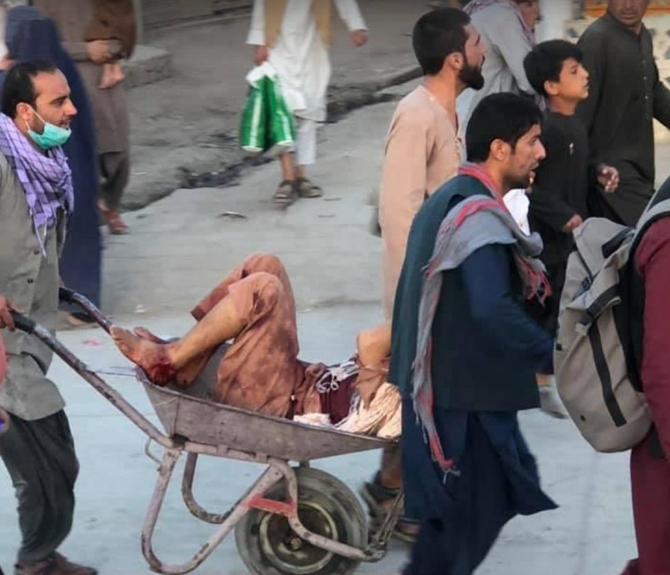 أفغانستان .. مصادر طبية تكشف الحصيلة الكاملة لضحايا انفجار مطار كابل
