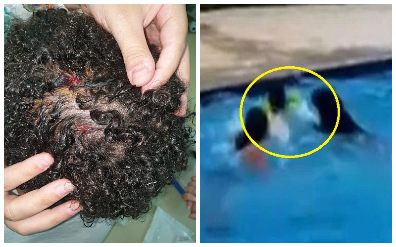 شاهد: لحظة هجوم كلب "شرس" على طفل داخل مسبح بقرية سياحية مصرية