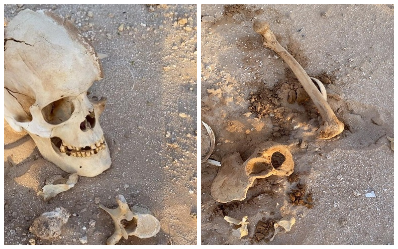 شاهد: ظهور "عظام وجماجم بشرية" فوق الأرض في الأفلاج.. والكشف عن السبب