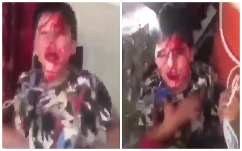 شاهد.. عراقي يعذب طفله بطريقة وحشية ويضربه حتى سالت الدماء من وجهه