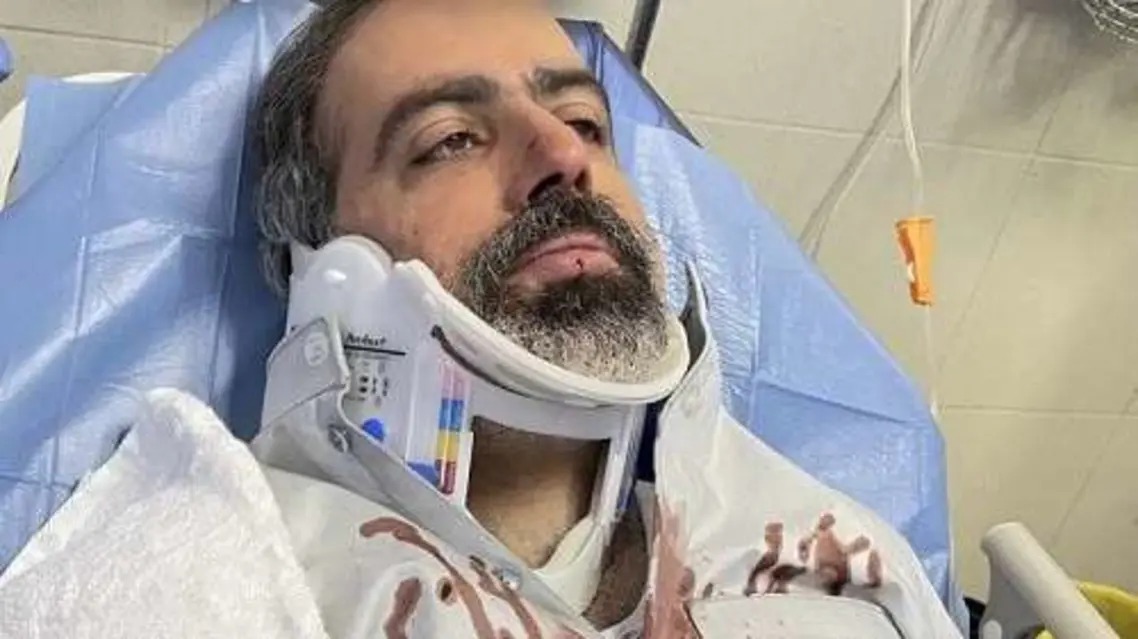 إصابة فنان كويتي بحادث مروع  وزوجته  تنشر صورته ملطخا بالدماء- صور