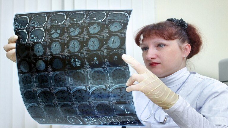 أطباء ألمان يكشفون خمس علامات تنذر بقرب الجلطة الدماغية