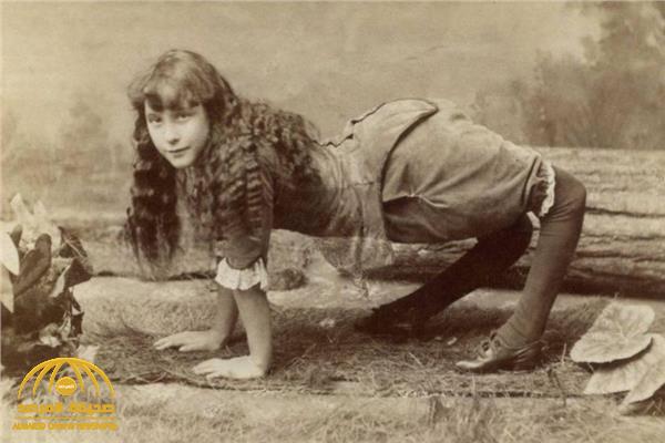 بالصور: تعرف على قصة أغرب فتاة أمريكية ولدت بعيب خلقي .. وأصبحت أشهر عارضة سيرك  في عام 1882