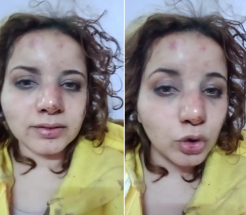 هددني بتشويه وجهي..  شاهد: مصرية تتعرض للضرب بوحشية على يد زوجها لسبب غريب 