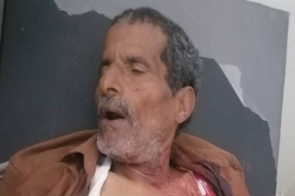 كان متجهاً لإسعاف ابنته في المستشفى.. تفاصيل مقتل مسن أمام عائلته على يد قناص حوثي   