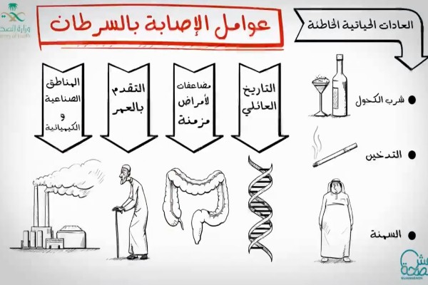 "الصحة" تنشر مقطع لاستشاري سعودي يشرح طرق بسيطة تقي الشخص من الإصابة بالسرطان -فيديو